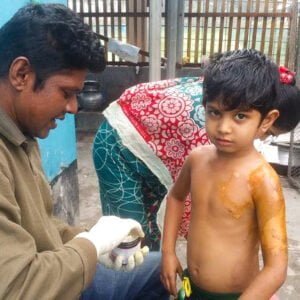 A small boy receives treatment for burns to his torso